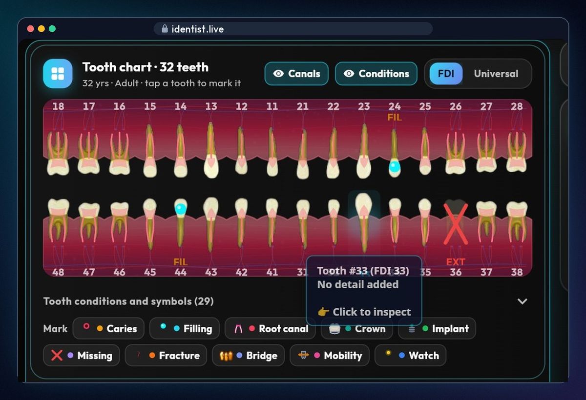 Tooth chart — the iDentist.Live patient file