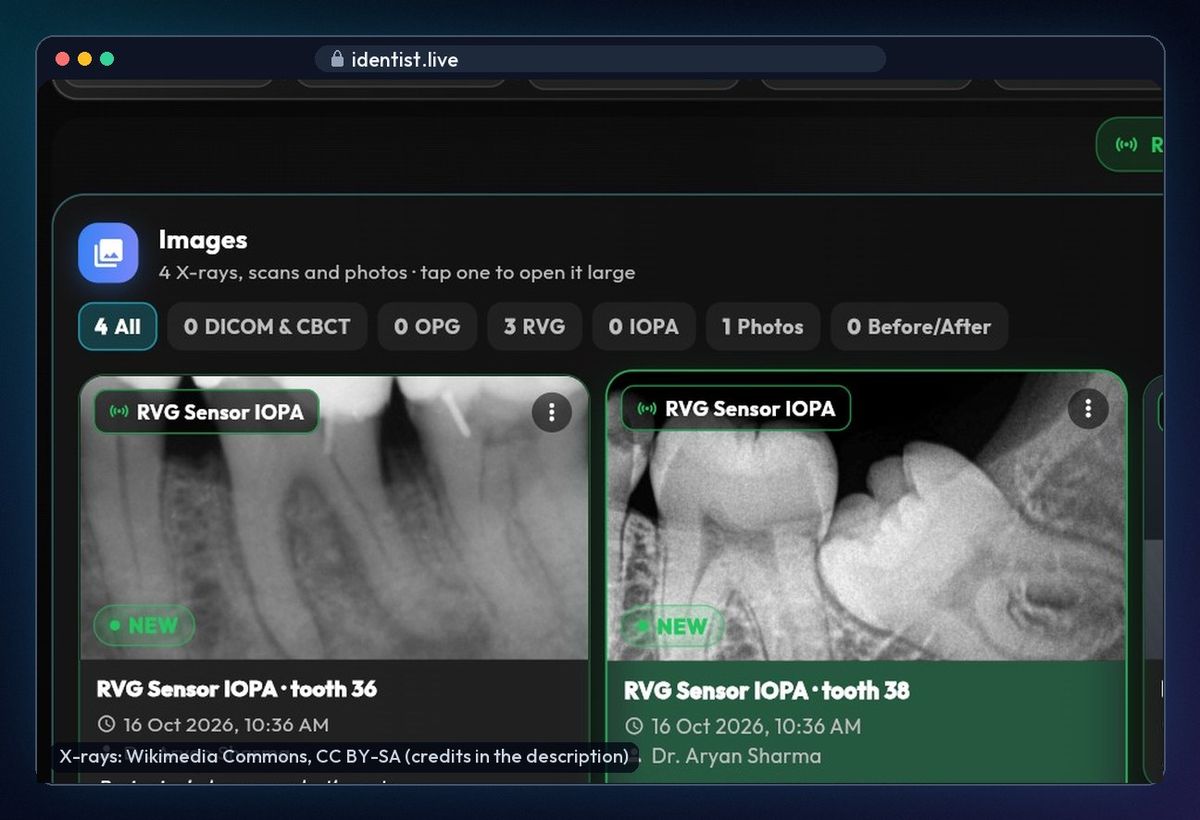 X-rays and photos — the iDentist.Live patient file