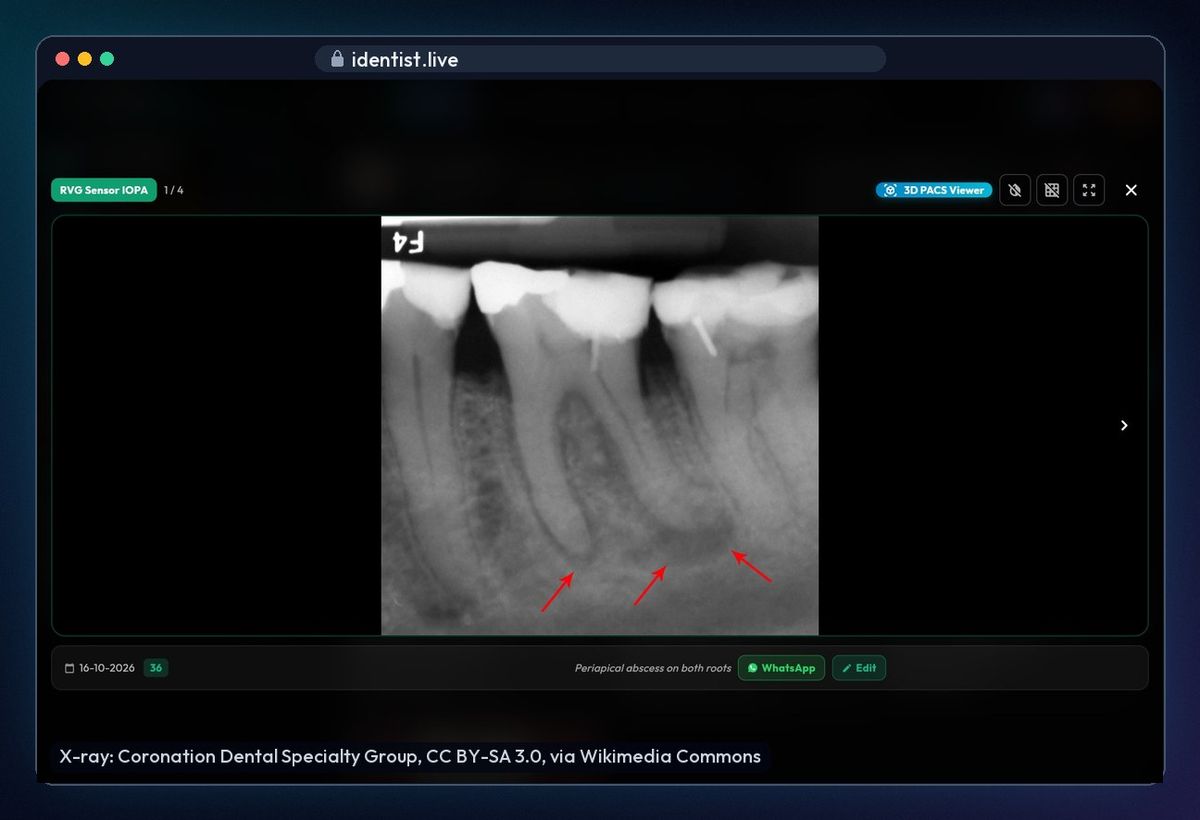 Open an X-ray large — the iDentist.Live patient file